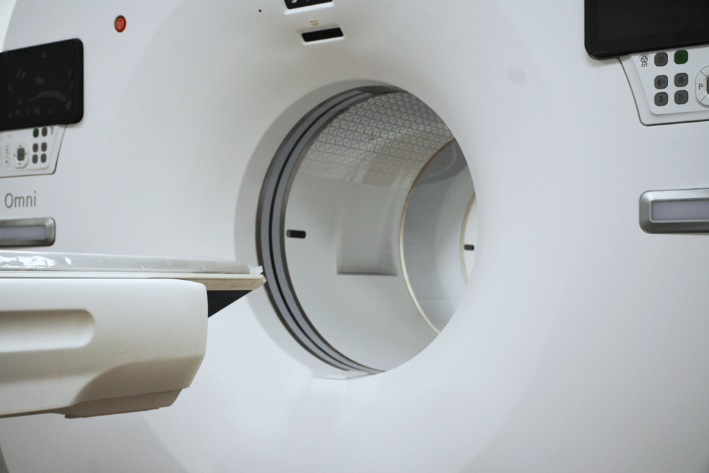 ct angiography heart report